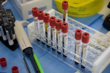 Avviso programmazione prelievi per i mesi di novembre e dicembre.