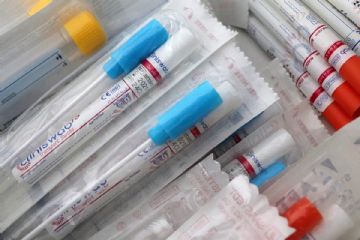 Rimodulazione attività di prelievo ematico agosto 2026